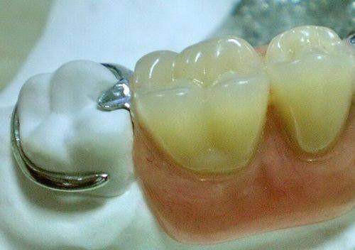 天津伊诚口腔门诊部真人口碑评价怎么样？