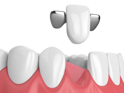 天津伊诚口腔门诊部收费价格表/收费标准