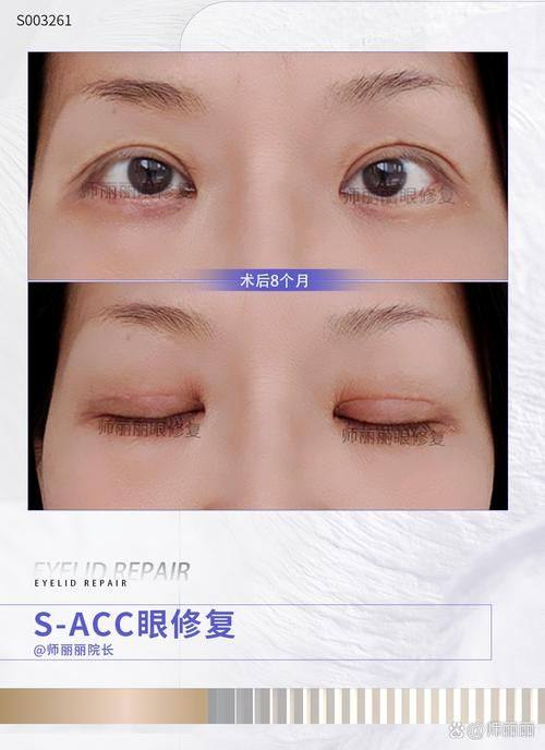 儋州红妆整形医疗美容门诊部收费价格表/收费标准