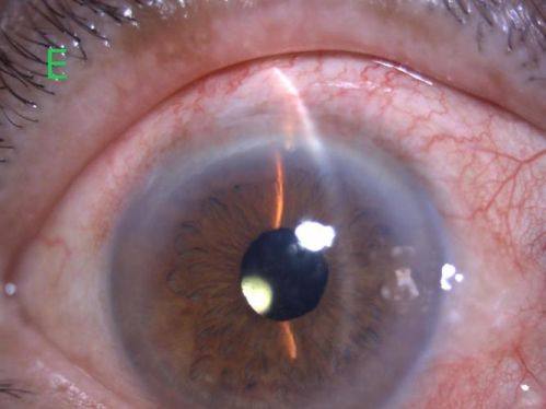 玉溪艾维（华 山）眼科医院医生团队实力强大及骨干医生简介