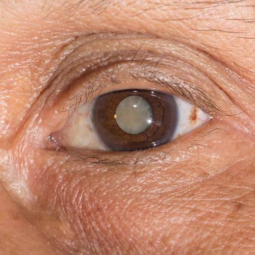 玉溪艾维（华 山）眼科医院真人口碑评价怎么样？