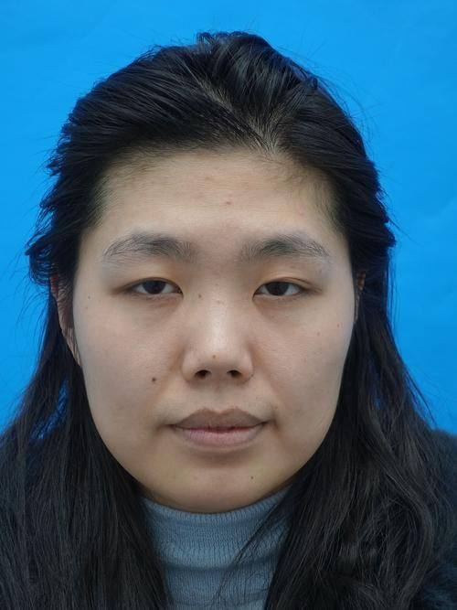 儋州红妆整形医疗美容门诊部详细的预约挂号方式及流程