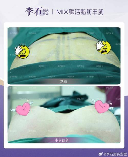 威海威高梨花美容整形医院收费价格表/收费标准