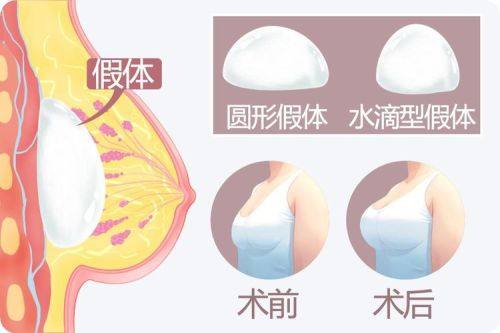 济南雅思医疗美容整形门诊部真人口碑评价怎么样？