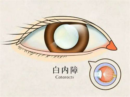 阜南县人民医院眼科收费价格表/收费标准
