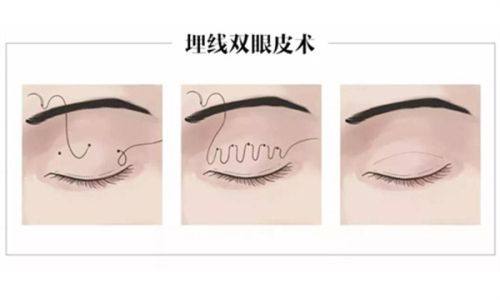 东营胜利油田中 心医院整形美容外科特色项目及技术优势