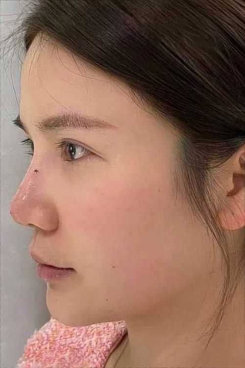 重庆艾薇美医疗美容门诊部特色项目及技术优势