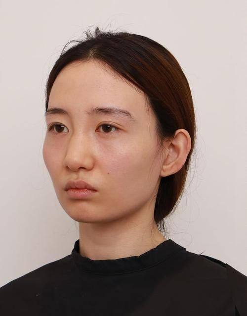 重庆艾薇美医疗美容门诊部真人口碑评价怎么样？