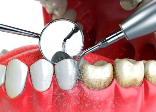 宁波市第一医院口腔综合门诊是正规医院吗？