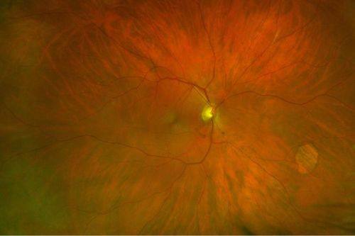武汉悦瞳眼科门诊收费价格表/收费标准