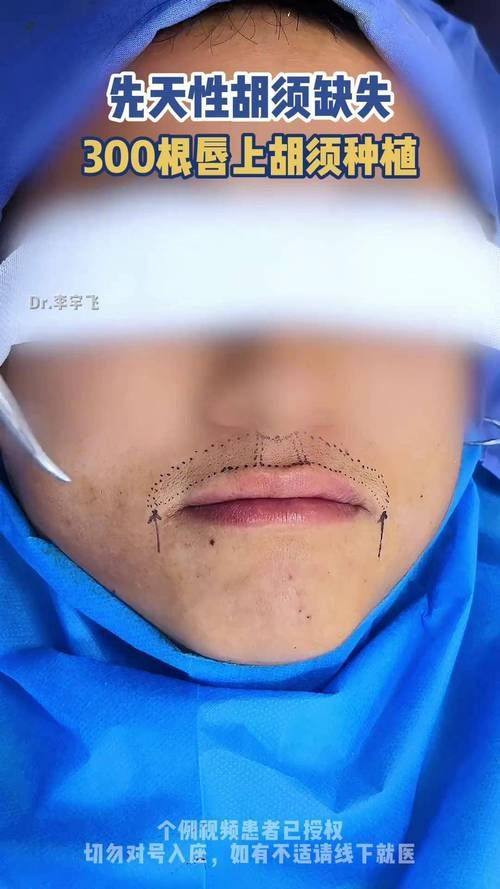 广州广大亿美植发医疗美容整形医院特色项目及技术优势