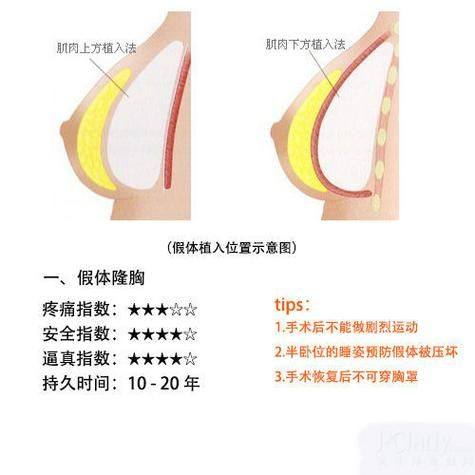 重庆艾薇美医疗美容门诊部收费价格表/收费标准