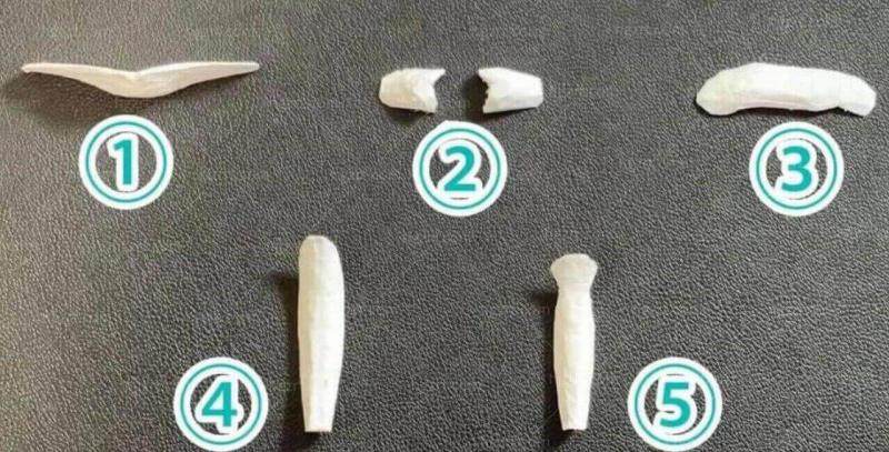 韩国BL整形外科特色项目及技术优势