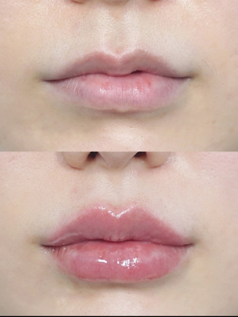 东营胜利油田中 心医院整形美容外科真人口碑评价怎么样？