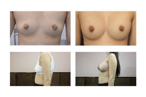 北京雅韵医疗美容医院真人口碑评价怎么样？