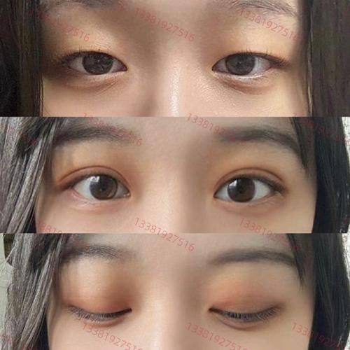 北京雅韵医疗美容医院详细的预约挂号方式及流程