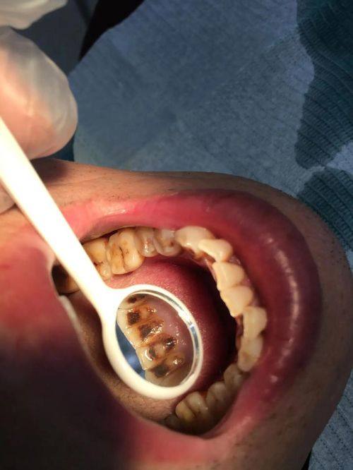 江西赣州张璐口腔详细的预约挂号方式及流程