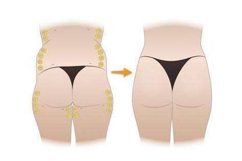 北京雅韵医疗美容医院收费价格表/收费标准