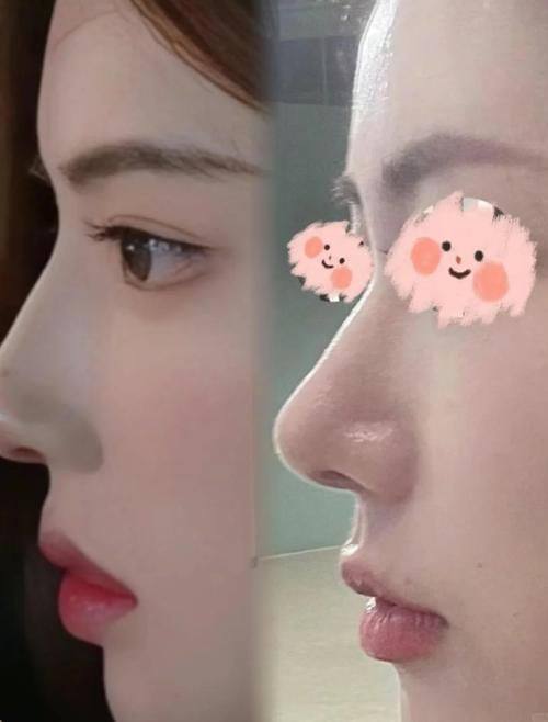 上海美莱整形医疗美容门诊部地址电话营业时间