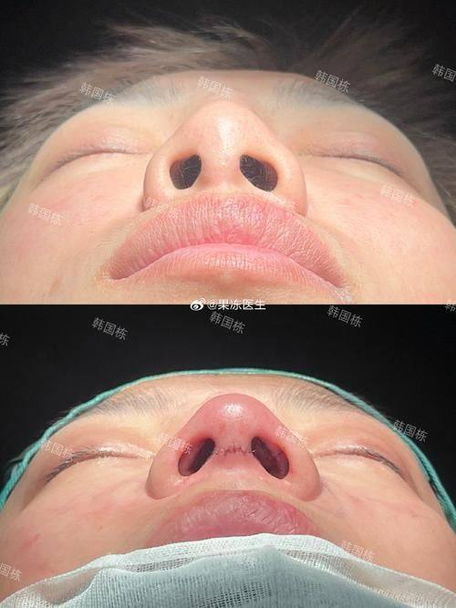 上海美莱整形医疗美容门诊部详细的预约挂号方式及流程