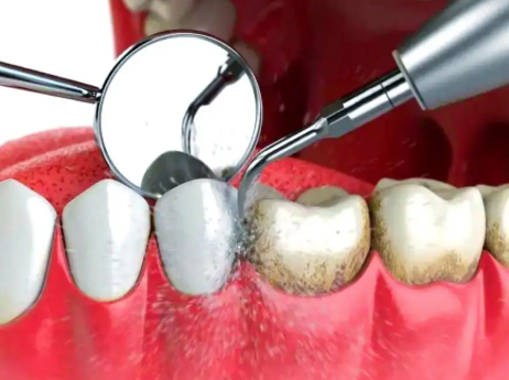 湖北咸宁赤壁德仁口腔特色项目及技术优势