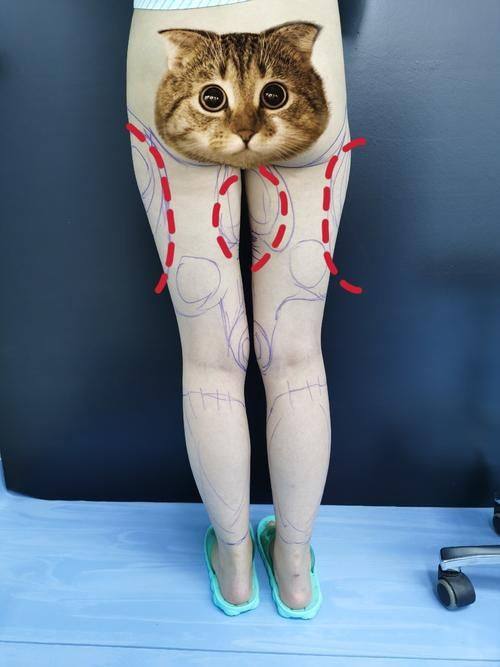 成都熹亚纪凡尼整形医院详细的预约挂号方式及流程