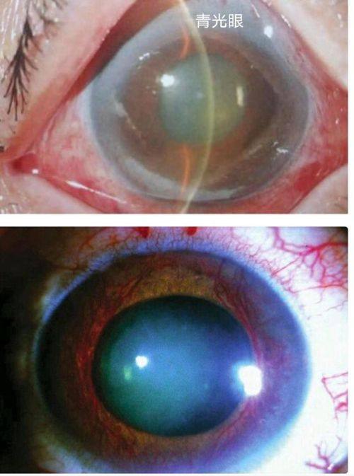 麻城市人民医院眼科收费价格表/收费标准
