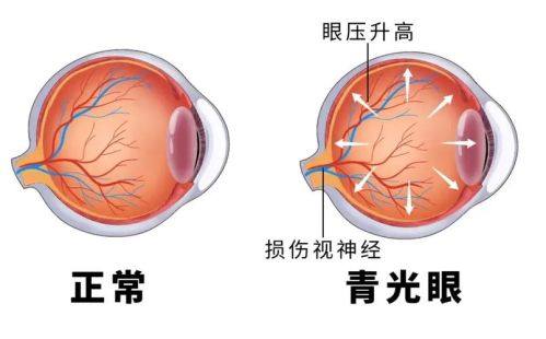 麻城市人民医院眼科真人口碑评价怎么样？