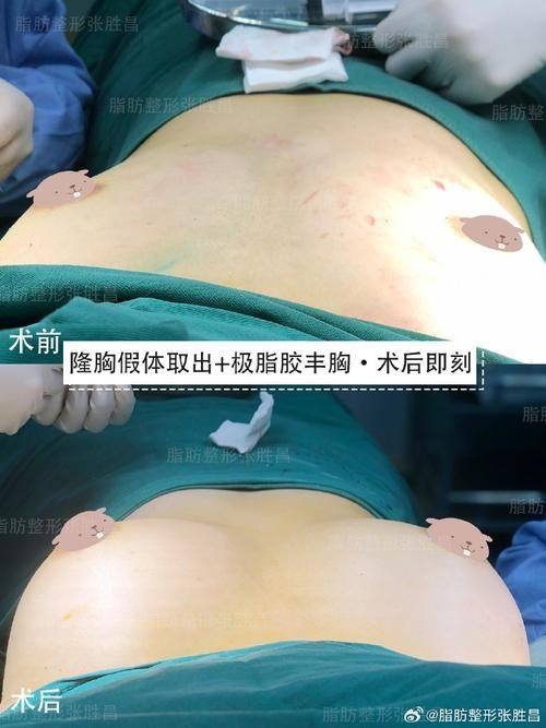 成都熹亚纪凡尼整形医院收费价格表/收费标准