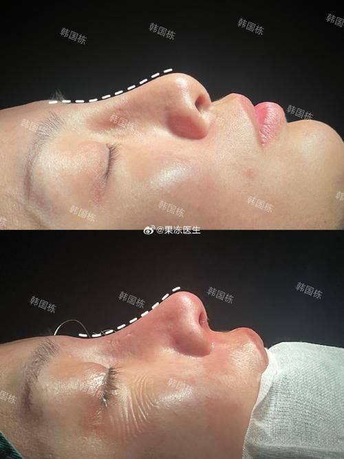 海南纯与美医学美容门诊部真人口碑评价怎么样？