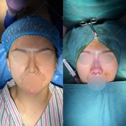 成都熹亚纪凡尼整形医院特色项目及技术优势