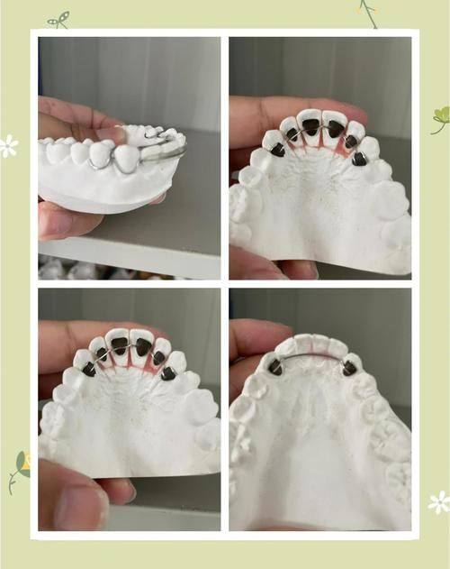 湖南长沙牙白兔万芙口腔门诊部真人口碑评价怎么样？