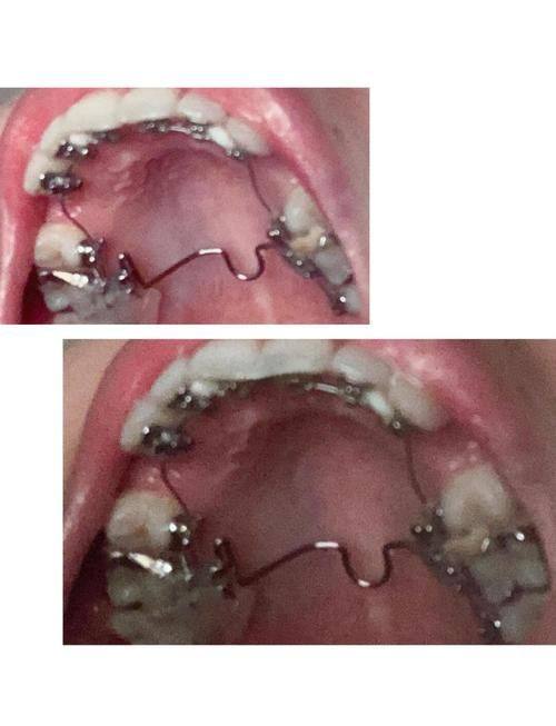 浙江嘉兴瑞民口腔门诊部真人口碑评价怎么样？