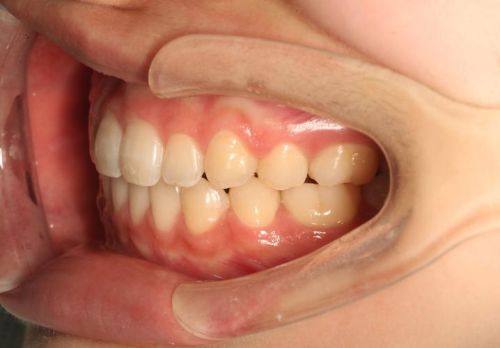 浙江嘉兴瑞民口腔门诊部是正规医院吗？