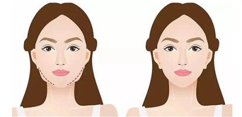 湖南申美芯医疗美容门诊部真人口碑评价怎么样？