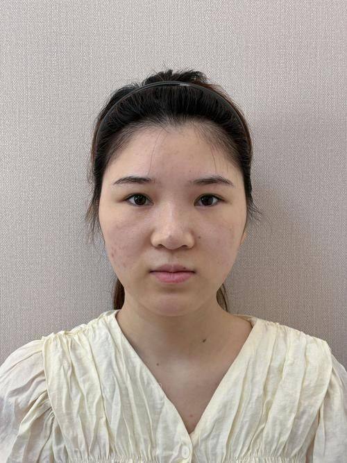 大连初颜医疗美容诊所收费价格表/收费标准