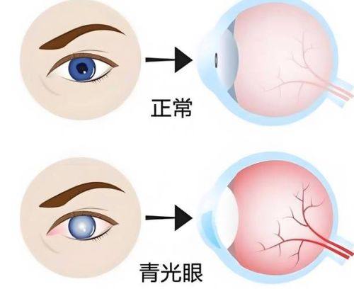 梅州市人民医院眼科真人口碑评价怎么样？