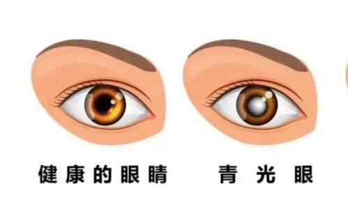 梅州市人民医院眼科收费价格表/收费标准