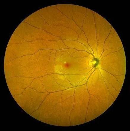 梅州市人民医院眼科是正规医院吗？