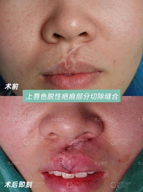 四川成都军建整形美容医院真人口碑评价怎么样？