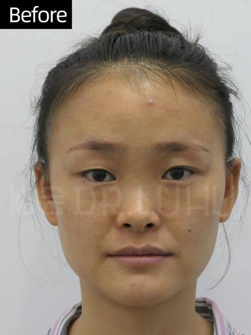 大连初颜医疗美容诊所真人口碑评价怎么样?