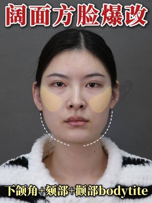 河北沧州红提医疗整形医院是正规医院吗？