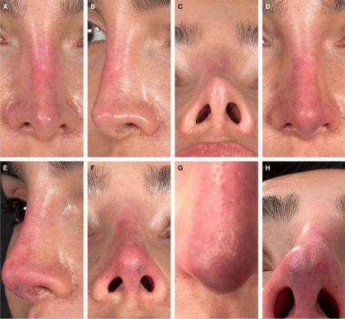 河北沧州红提医疗整形医院地址电话营业时间