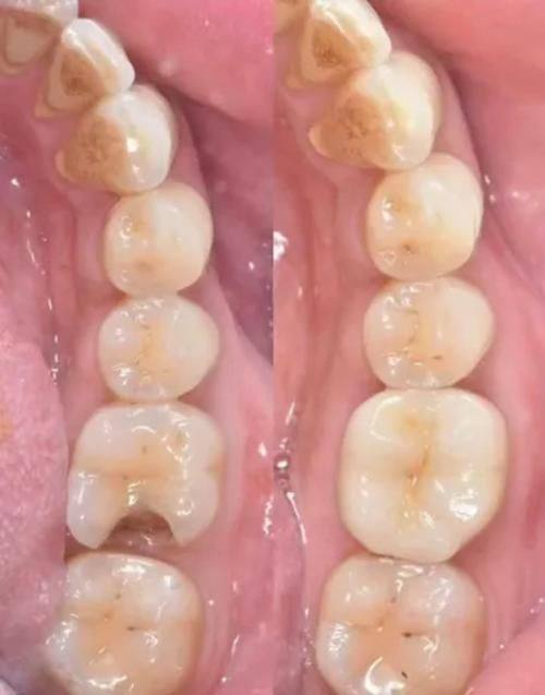 湖南长沙熙美口腔连锁详细的预约挂号方式及流程