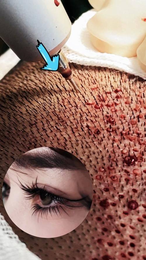 青岛洋美医疗美容诊所是正规医院吗?