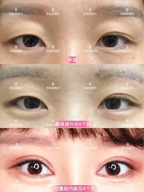 日照莒县汝颜轩铭整形医院真人口碑评价怎么样？