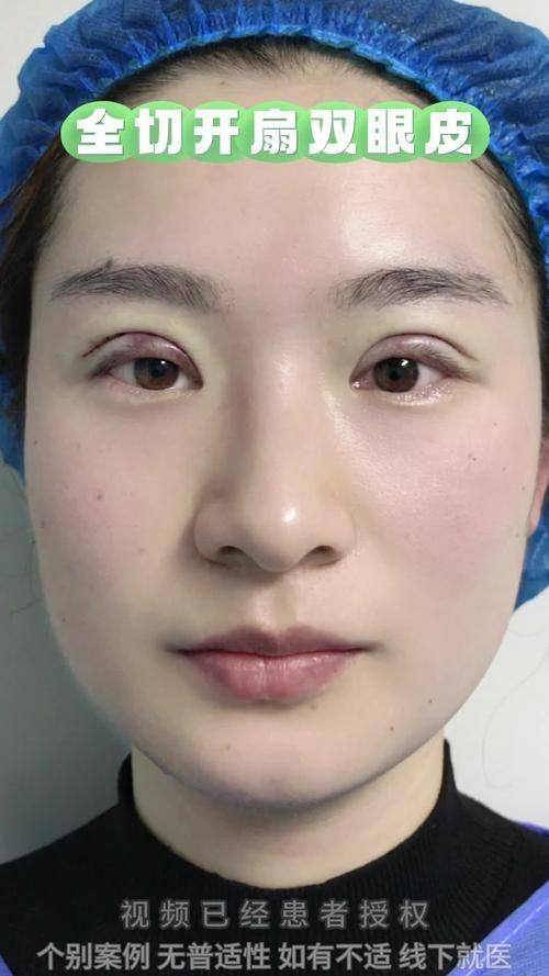 惠州美然医疗美容门诊部地址电话营业时间