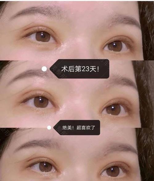 广州美莱医学美容医院真人口碑评价怎么样？