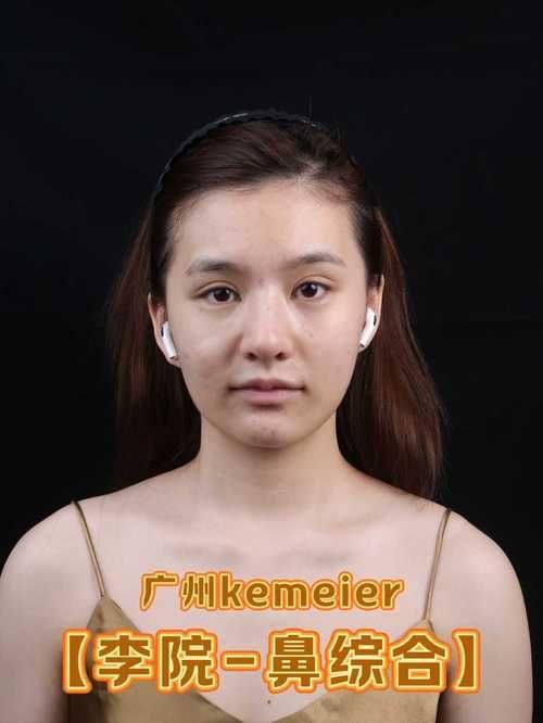 惠州美然医疗美容门诊部收费价格表/收费标准