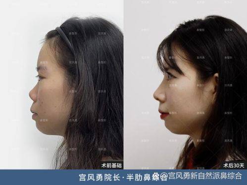 惠州美然医疗美容门诊部真人口碑评价怎么样？